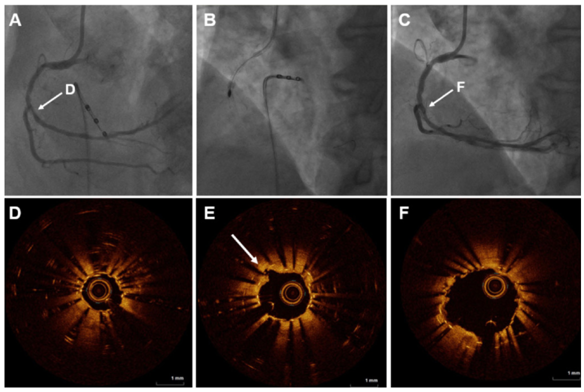 Dwivedi RotaTripsy Strategy Figure 2