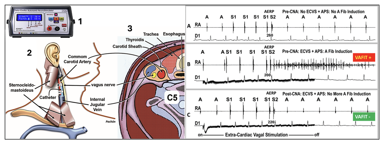 EPLD Pachon figure 1 March 2026