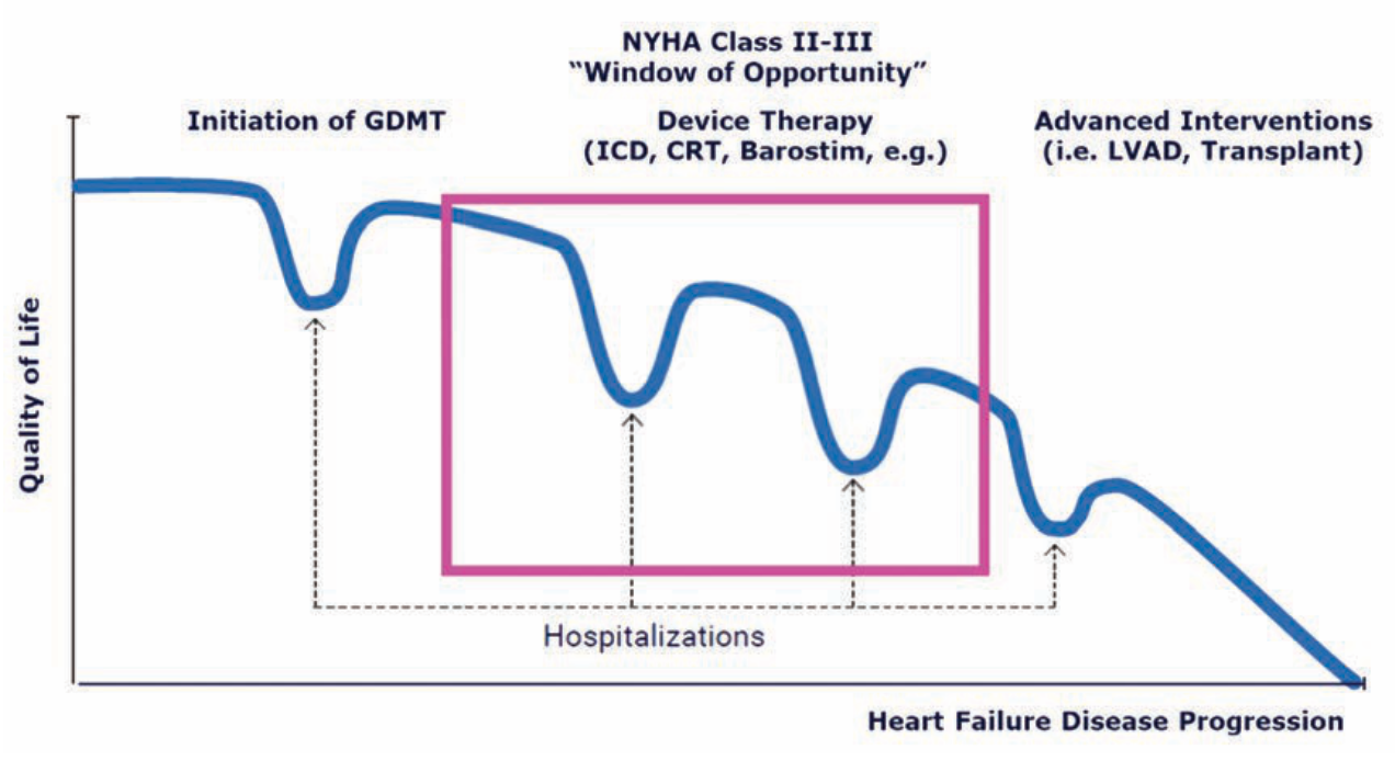 Economides Barostim System Figure 4