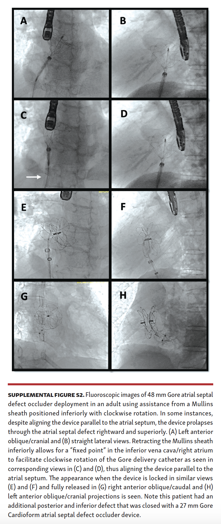 Eilers ASD Supple Fig S2