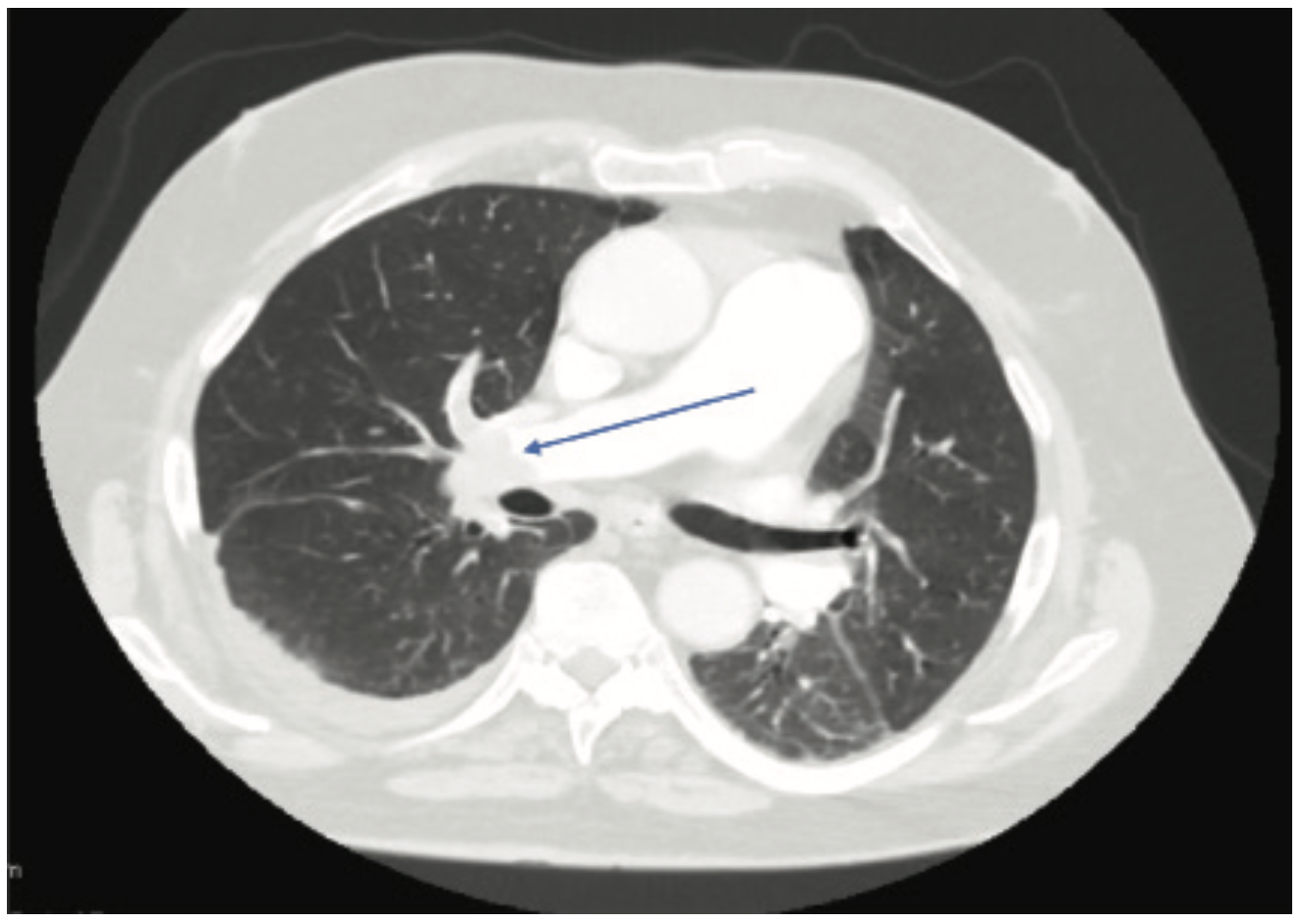 Elzanaty Clot Figure 1