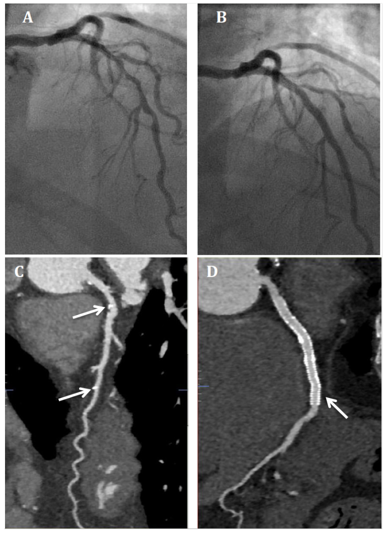 Ezad Vascular Scaffolds Figure 1