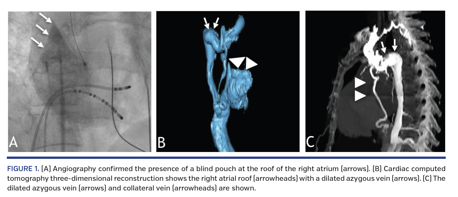 FIGURE 1. (A) Angiography.png