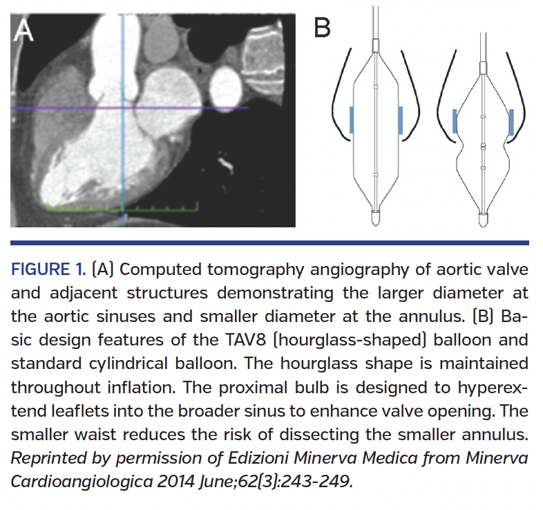 FIGURE 1. (A) Computed tomography angiography.png