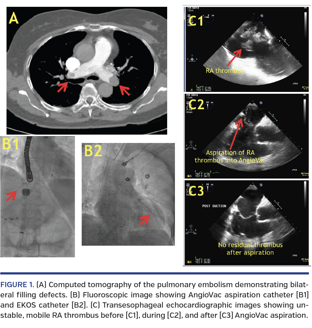 FIGURE 1. (A) Computed tomography.png