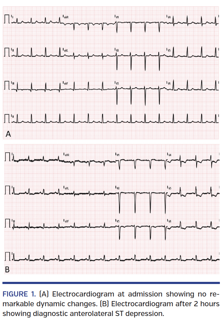 FIGURE 1. (A) Electrocardiogram.png