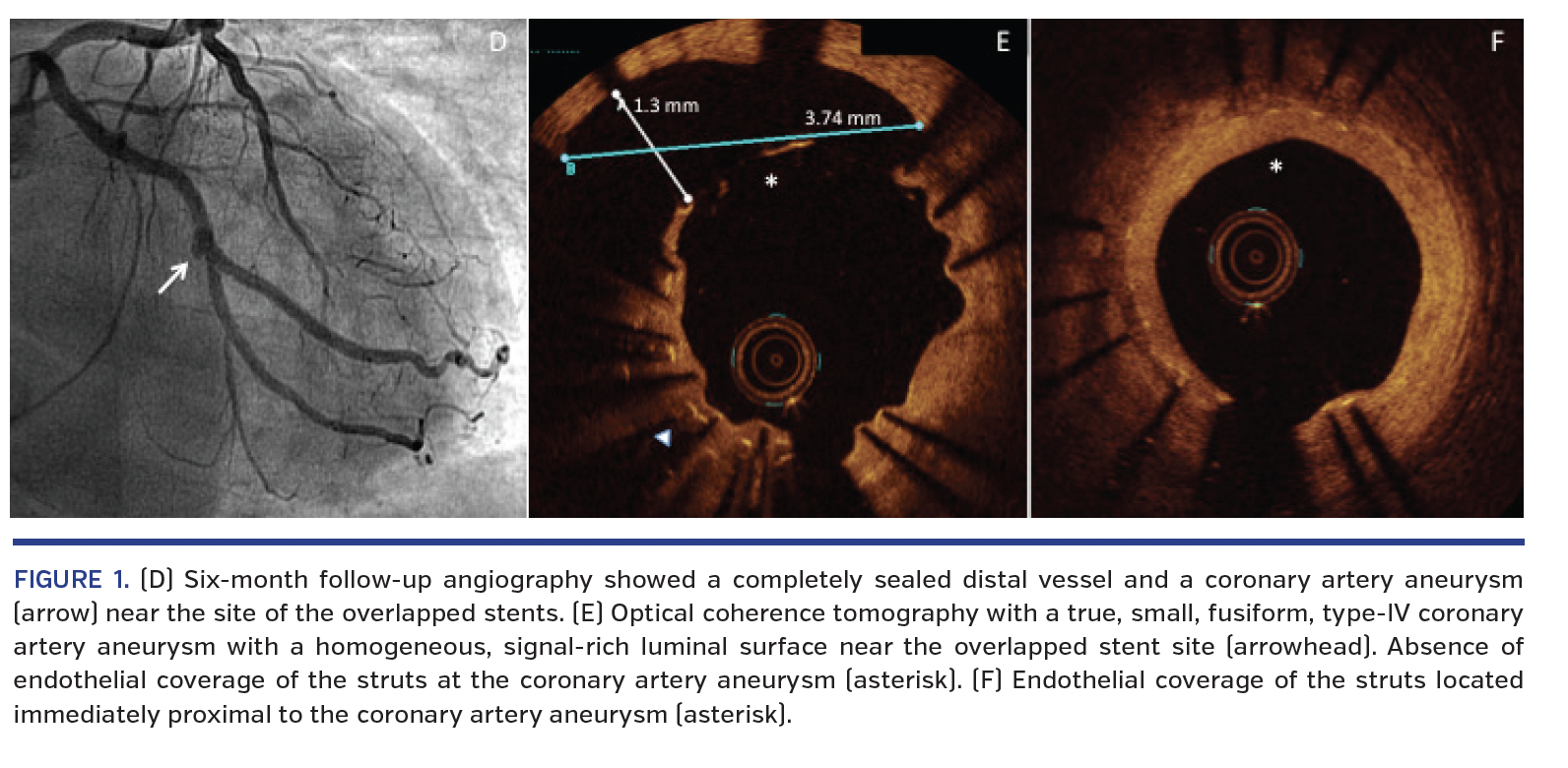 FIGURE 1. (D) Six-month follow-up.png