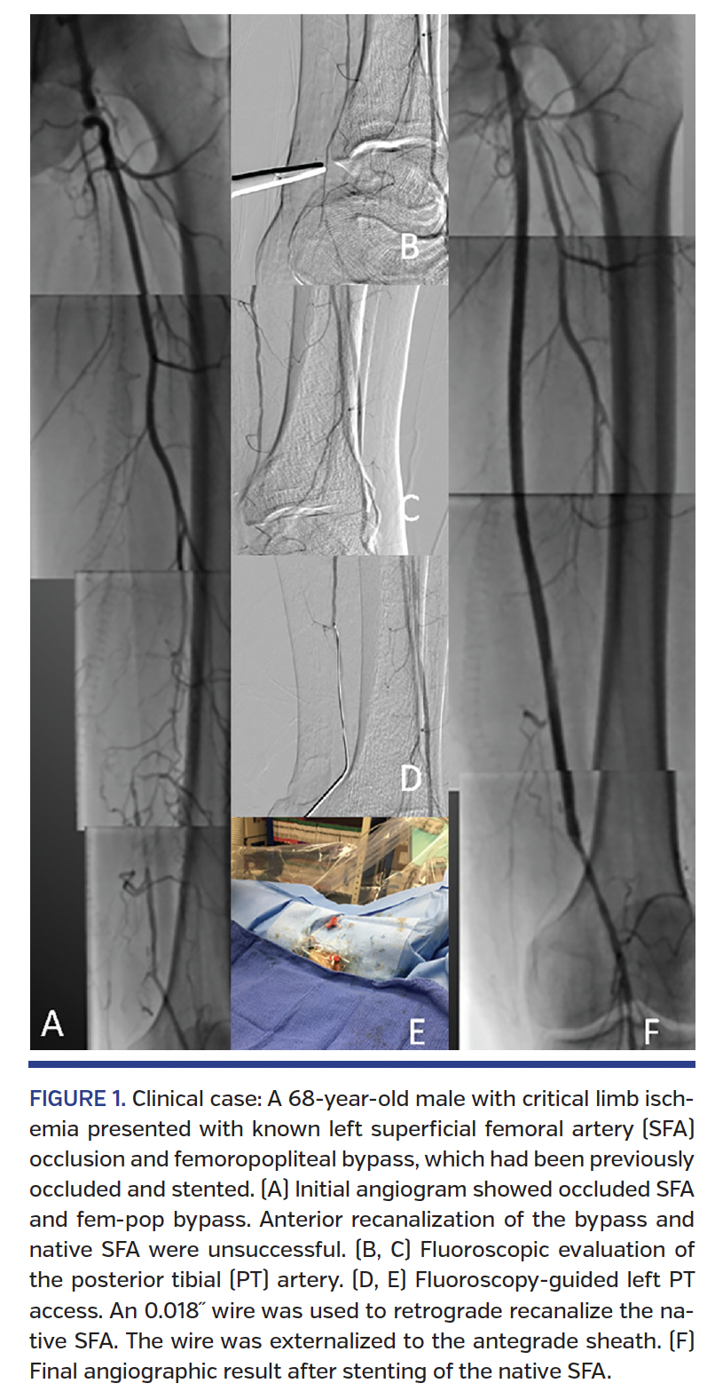 FIGURE 1. Clinical case.png