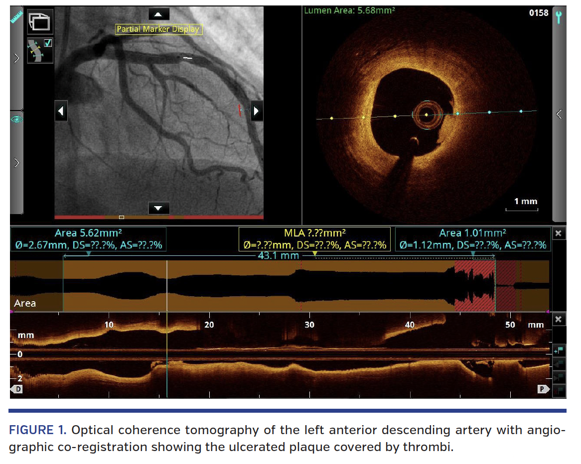 FIGURE 1. Optical coherence tomography.png