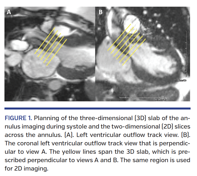 FIGURE 1. Planning of the three-dimensional (3D) slab.png