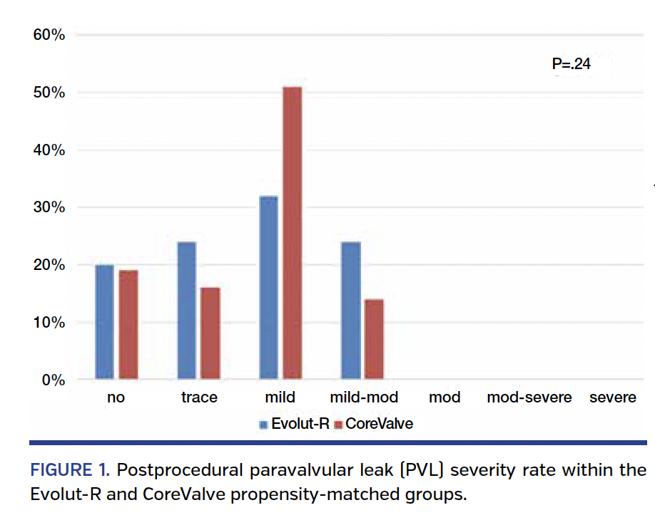 FIGURE 1. Postprocedural paravalvular leak