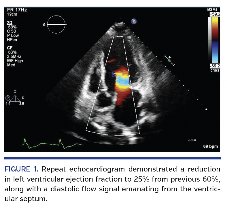 FIGURE 1. Repeat echocardiogram.png