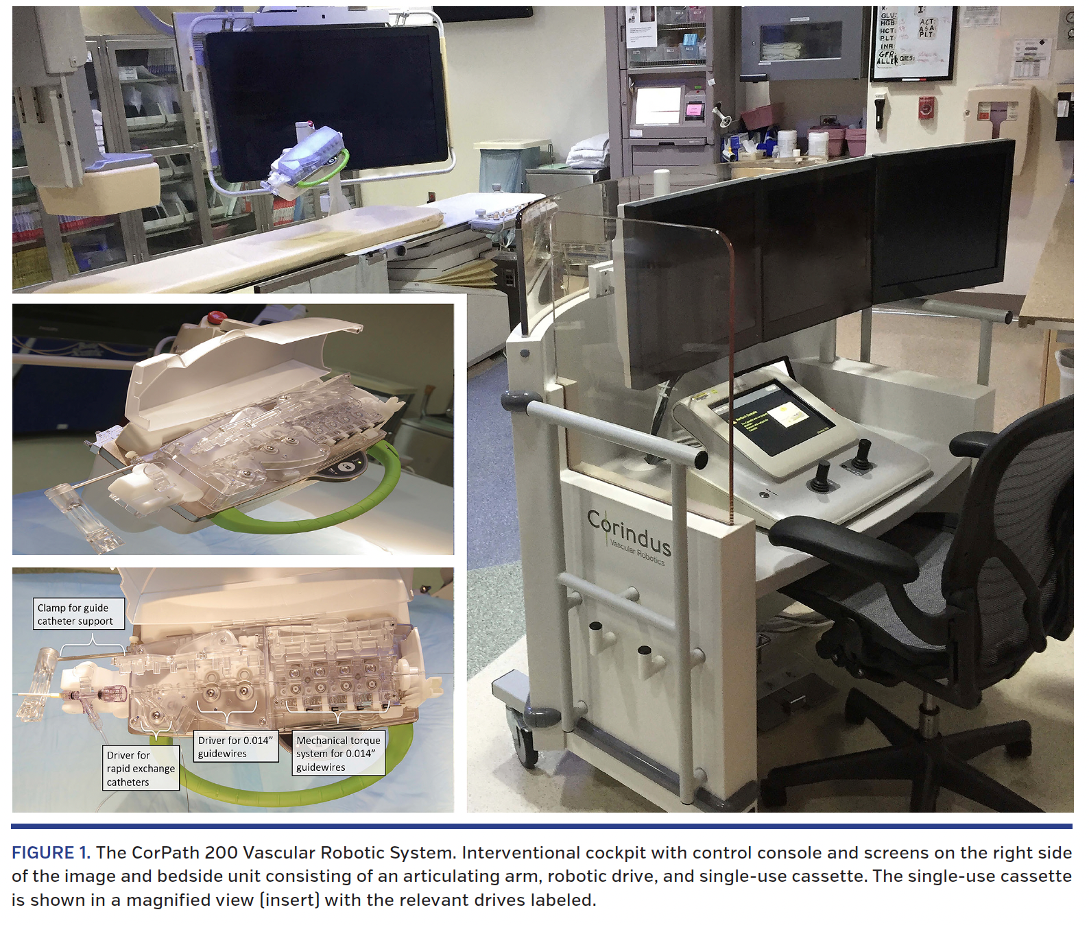 FIGURE 1. The CorPath 200 Vascular Robotic System..png