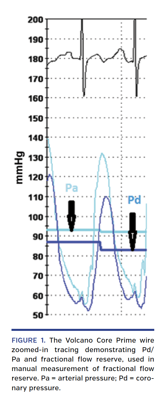 FIGURE 1. The Volcano Core Prime wire.png