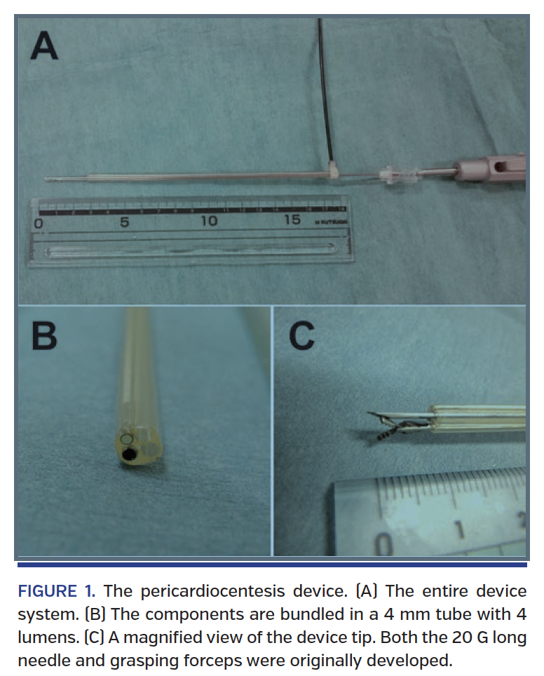FIGURE 1. The pericardiocentesis device..png
