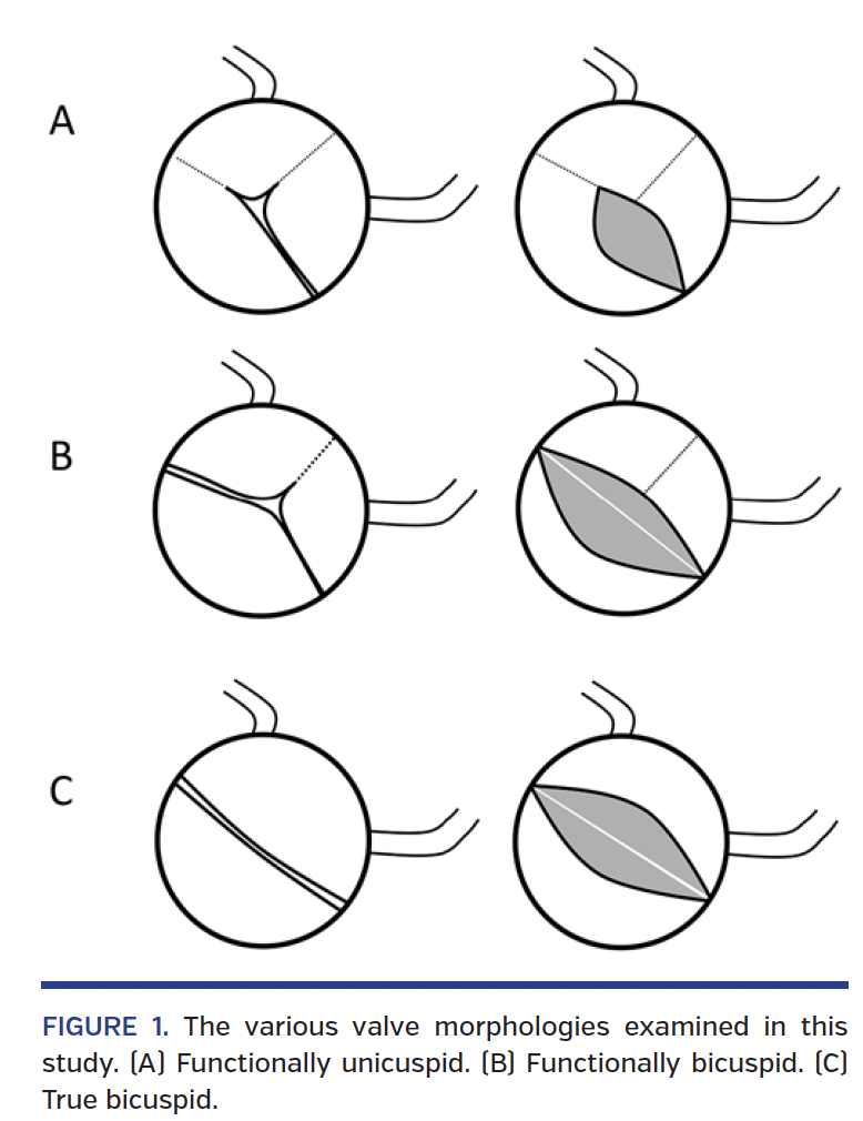 FIGURE 1. The various valve morphologies.png