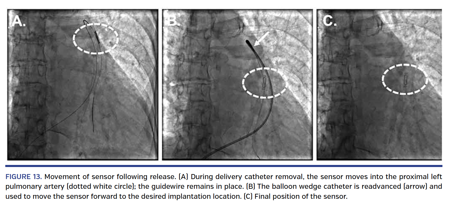 FIGURE 13. Movement of sensor following release..png