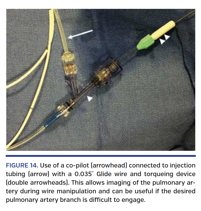 FIGURE 14. Use of a co-pilot.png