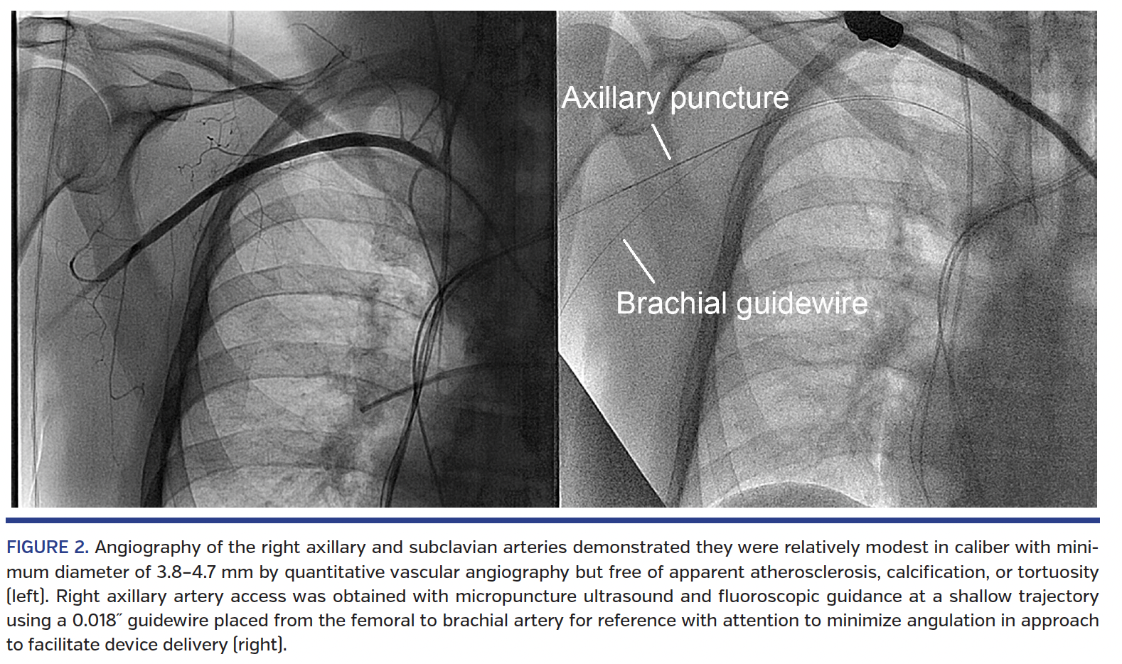 FIGURE 2. Angiography.png