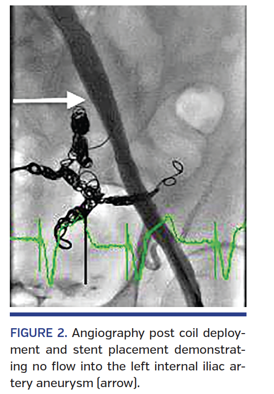 FIGURE 2. Angiography.png