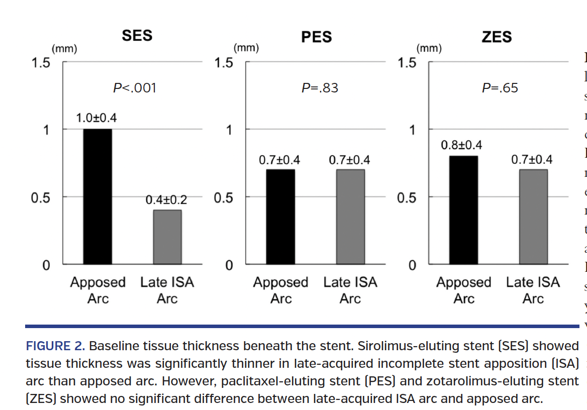 FIGURE 2. Baseline tissue thickness beneath the stent..png