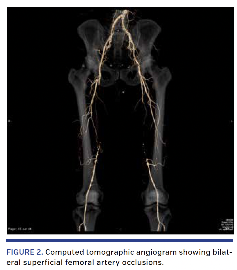FIGURE 2. Computed tomographic angiogram.png