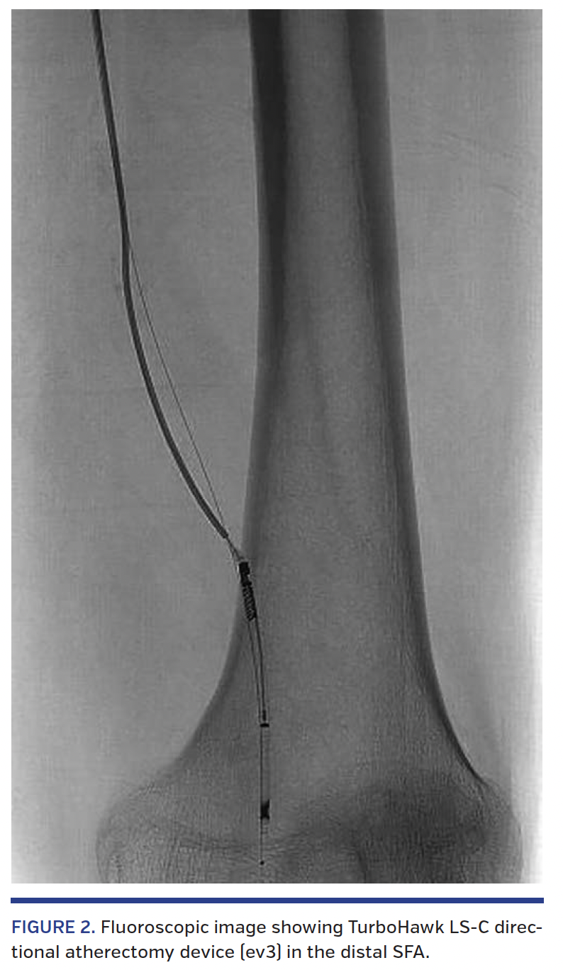 FIGURE 2. Fluoroscopic image.png