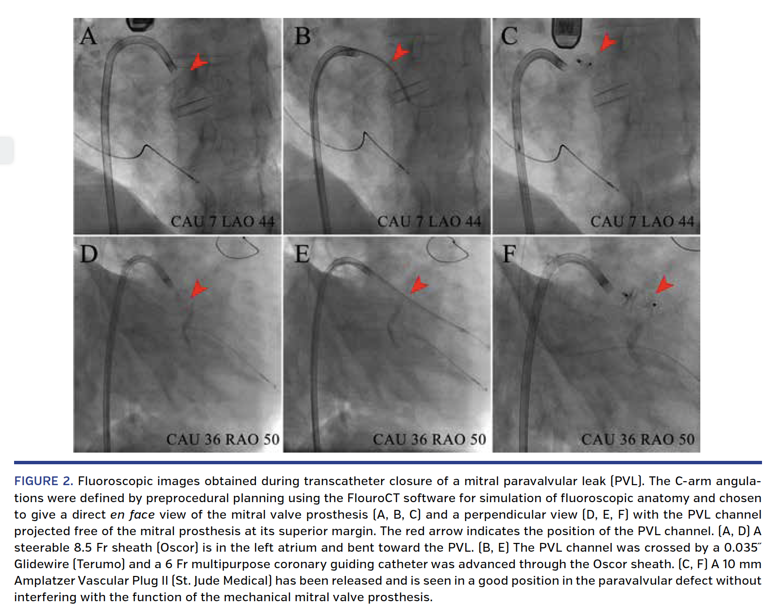 FIGURE 2. Fluoroscopic images.png