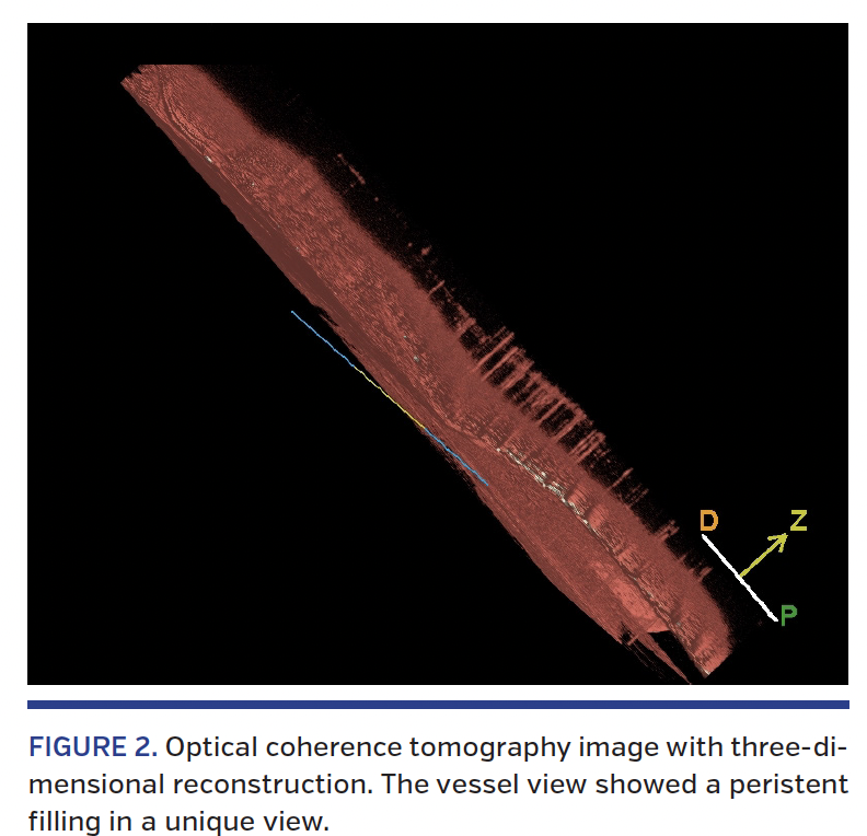 FIGURE 2. Optical coherence tomography.png