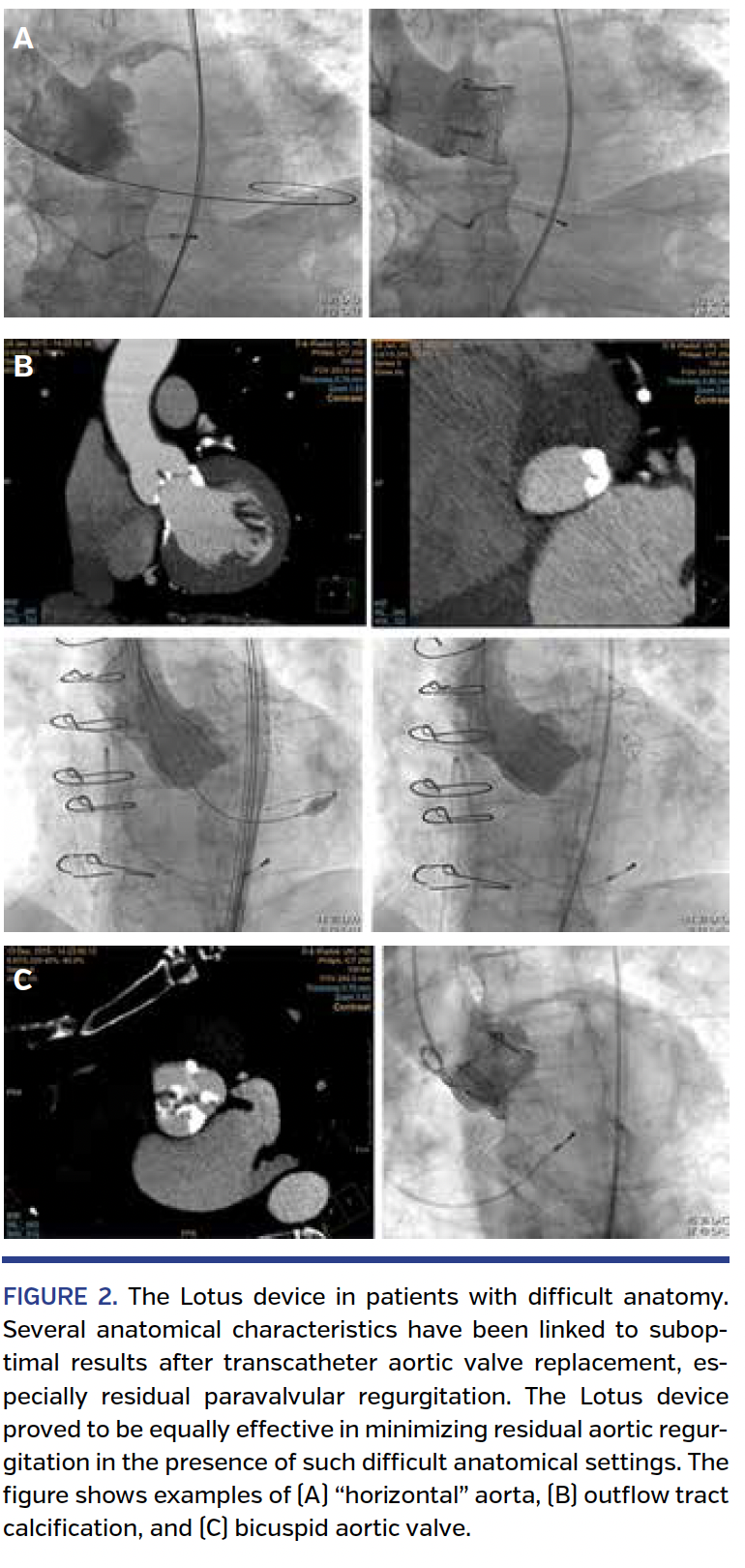 FIGURE 2. The Lotus device.png
