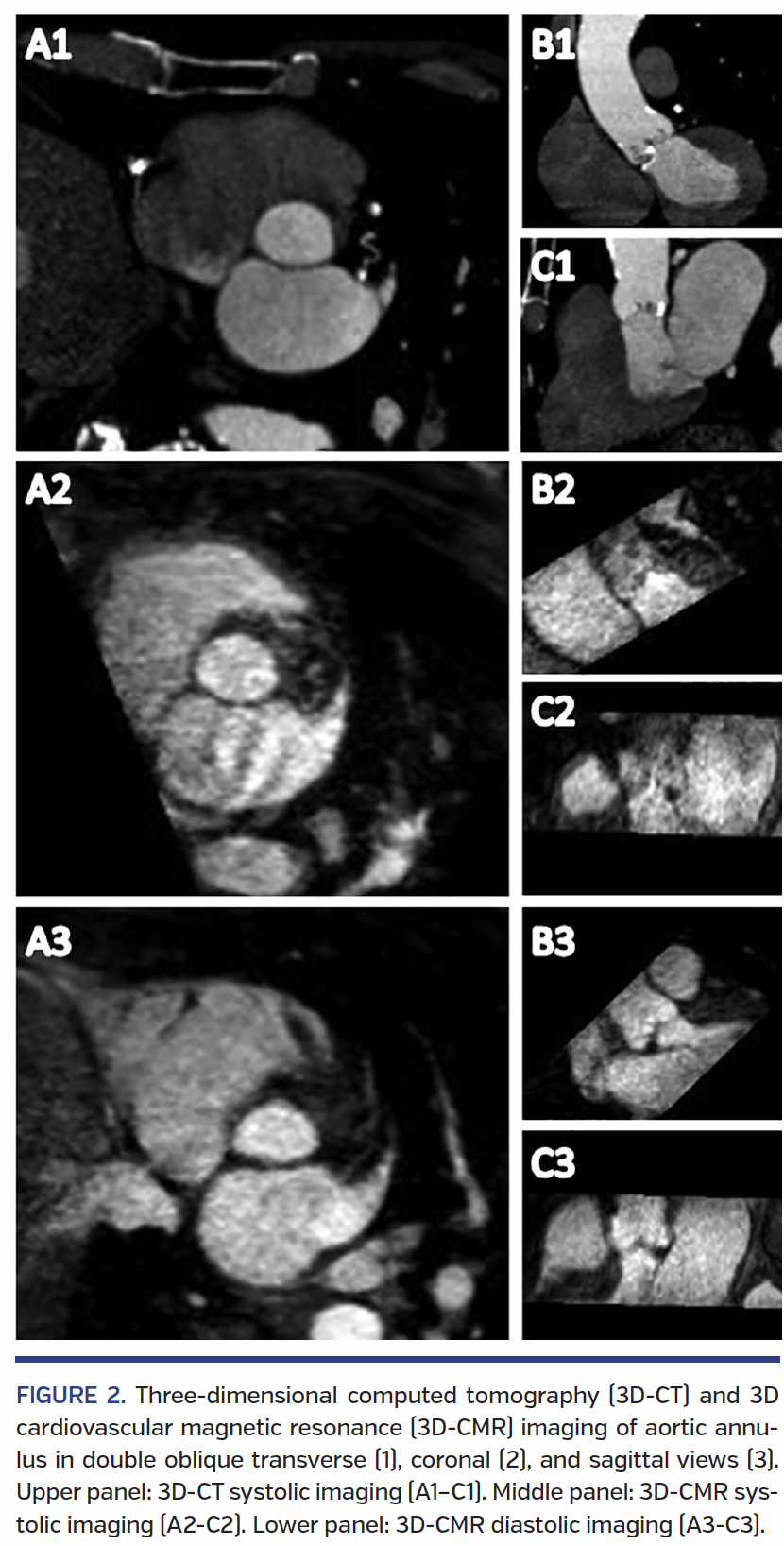 FIGURE 2. Three-dimensional computed tomography.png