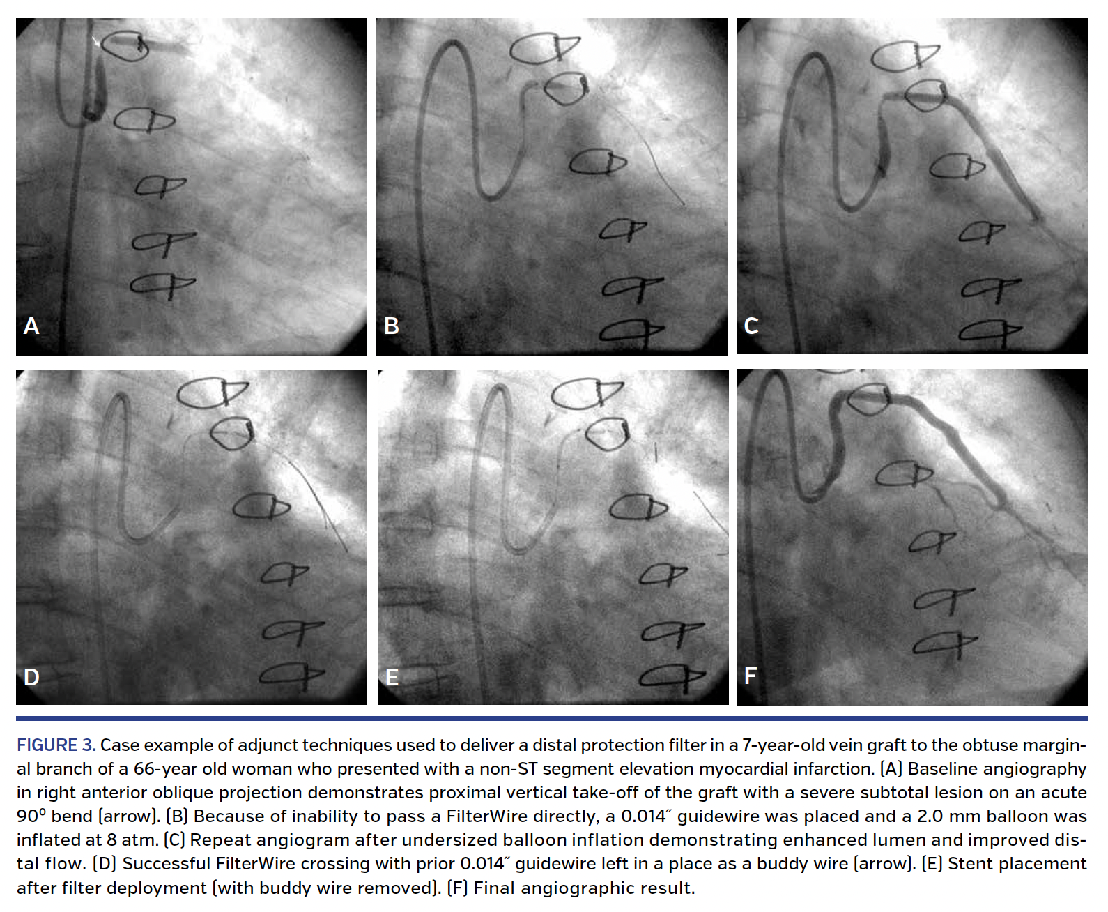 FIGURE 3. Case example.png