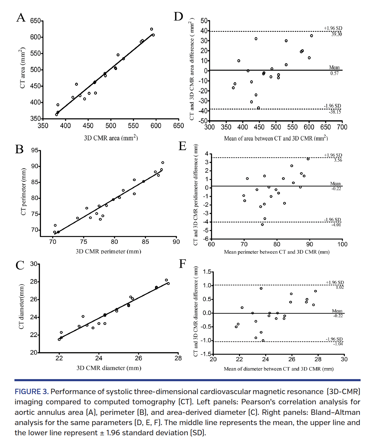 FIGURE 3. Performance of systolic three-dimensional cardiovascular magnetic resonance.png