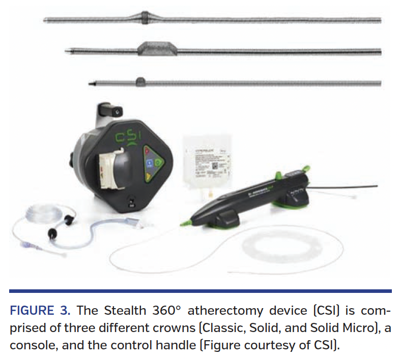 FIGURE 3. The Stealth 360° atherectomy device.png