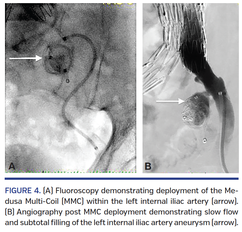FIGURE 4. (A) Fluoroscopy.png