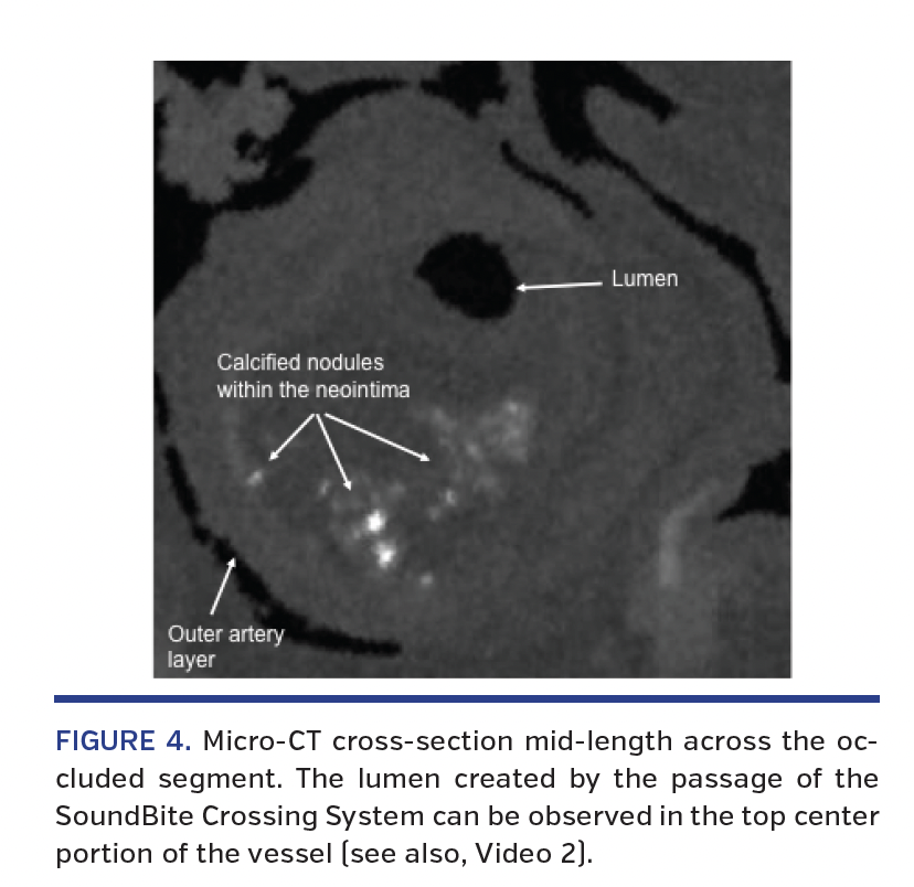 FIGURE 4. Micro-CT cross-section.png