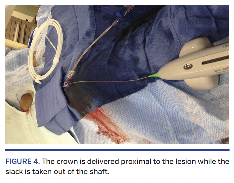 FIGURE 4. The crown is delivered.png