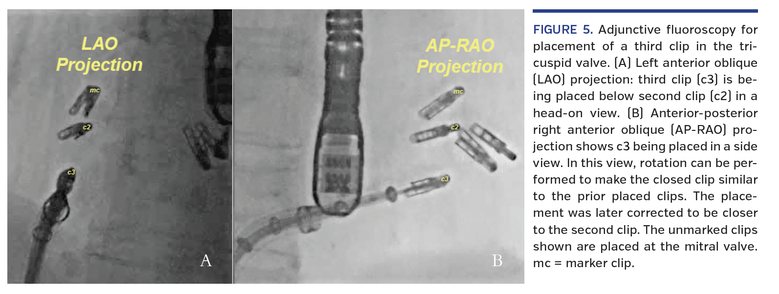 FIGURE 5. Adjunctive fluoroscopy.png