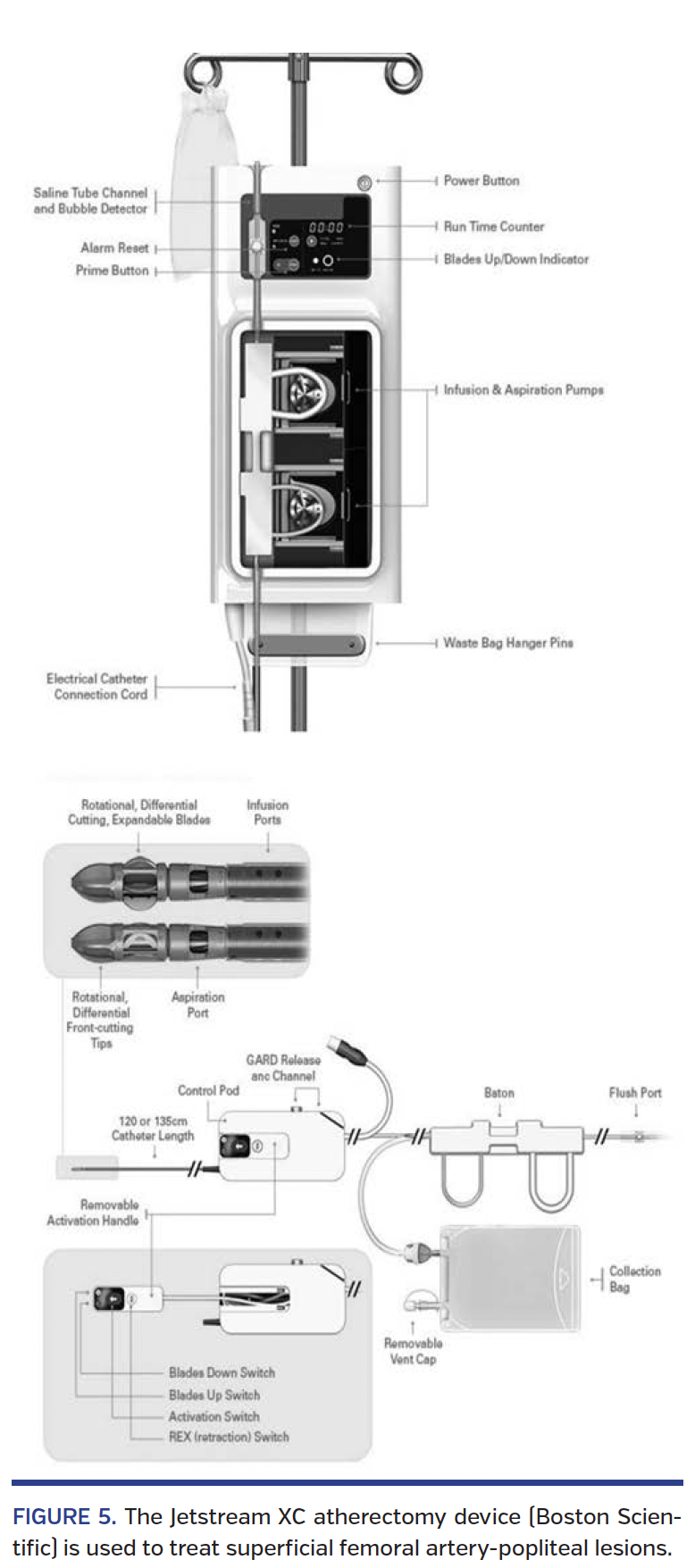FIGURE 5. The Jetstream XC atherectomy device.png
