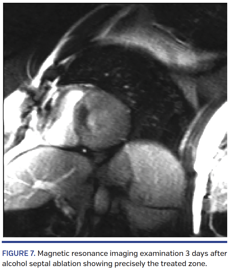 FIGURE 7. Magnetic resonance imaging.png