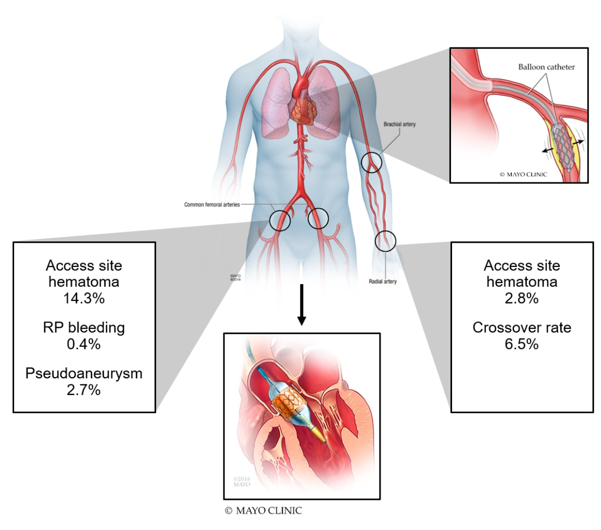 Farhat TAVR Figure 2