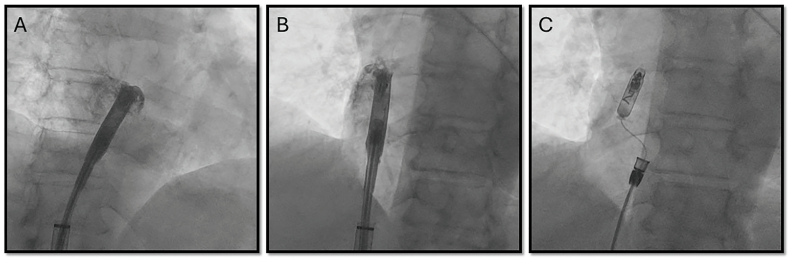 Farjo-Fig1-EPLD-April 2026