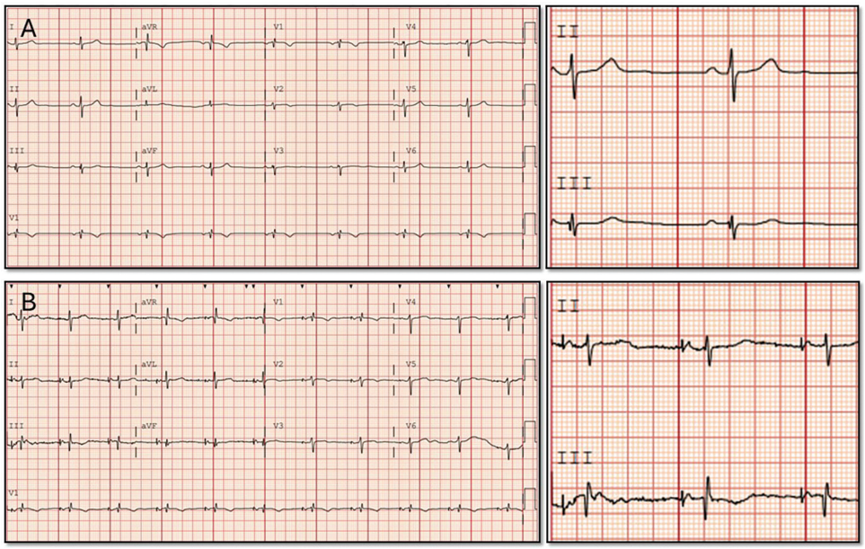 Farjo-Fig2-EPLD-April 2026