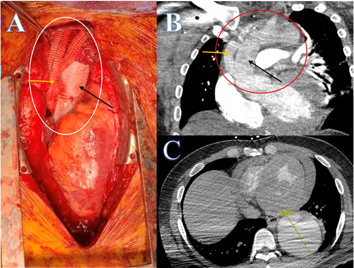 Figure. (A) Surgical view 