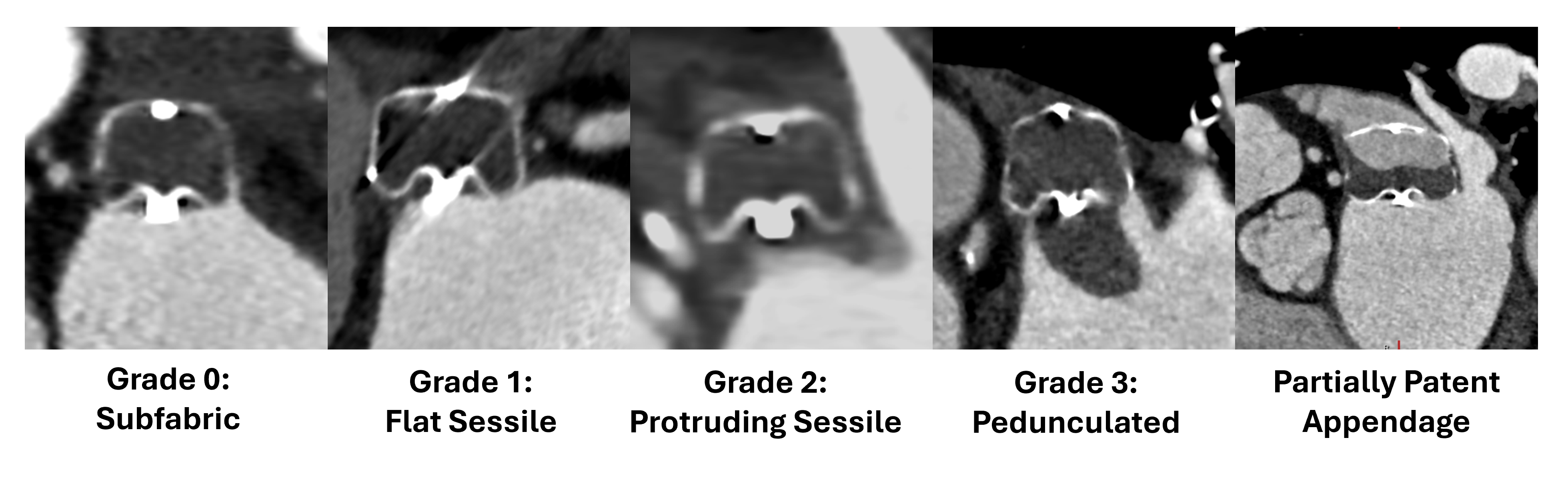 Figure 2. HAT morphologies