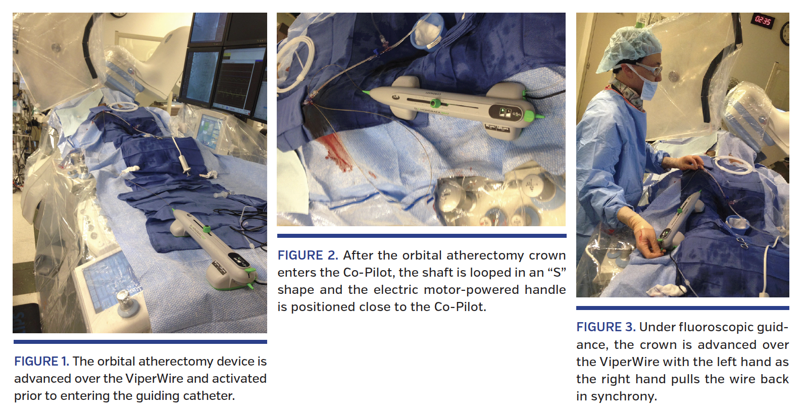 Device description, procedural technique, and medical treatment.