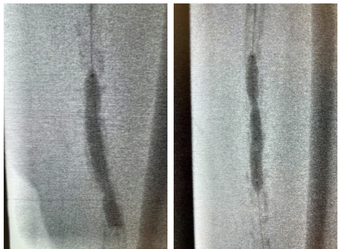 Figure 2 and Figure 3
