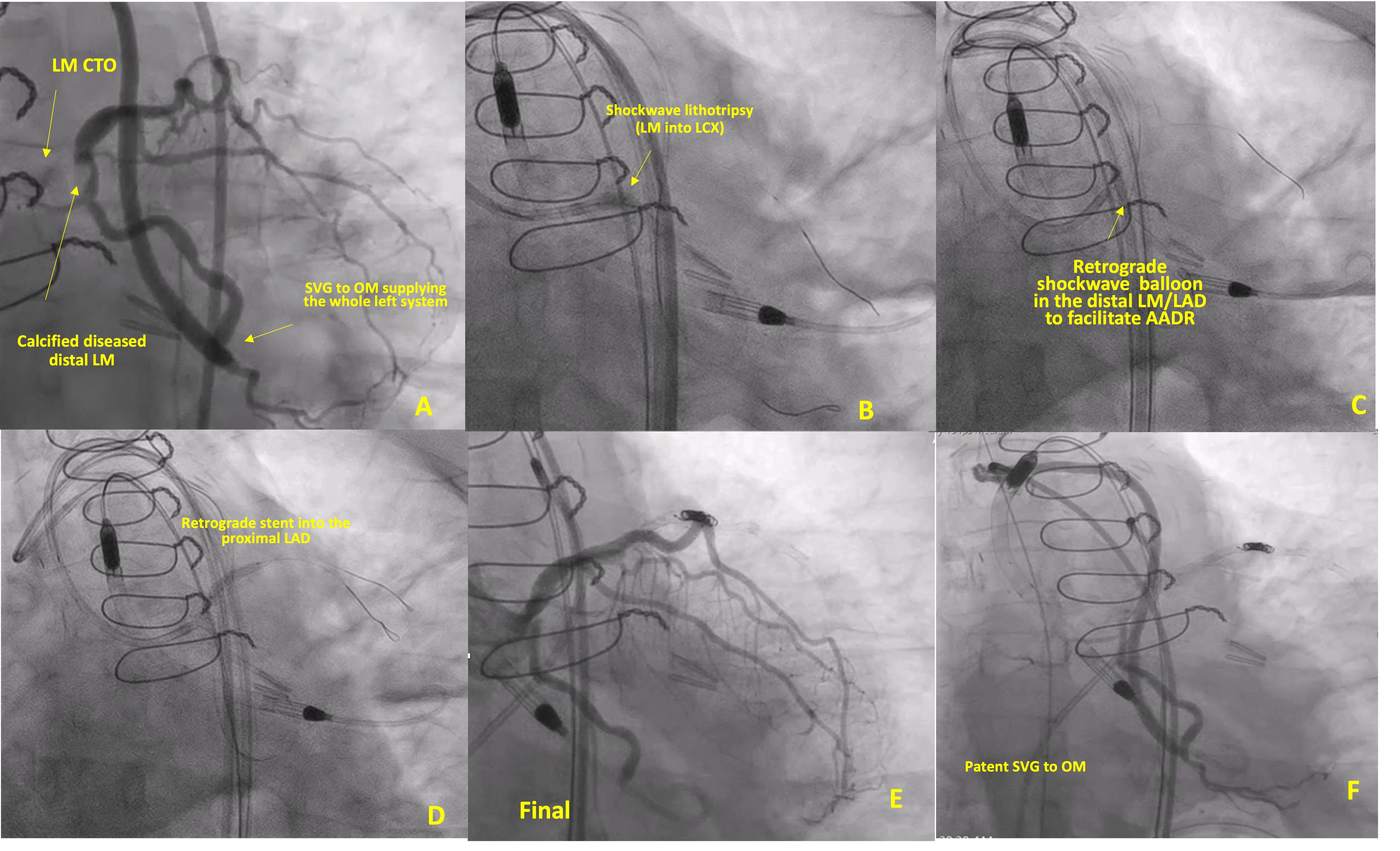 Figure 1. CTO of LM and SVG to OM