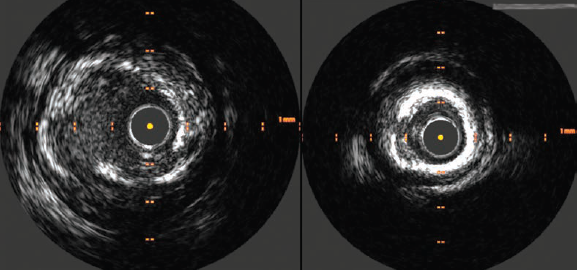 Fig2-Shaikh-Cortese-March2025