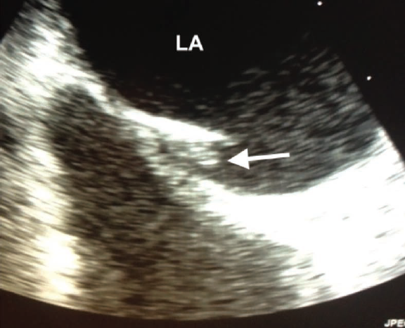 Fig3-Krishnan-March2025